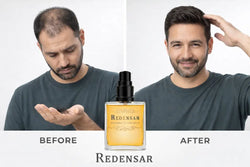 Redensar Hair Growth Serum for Thinning Hair & Hair Density