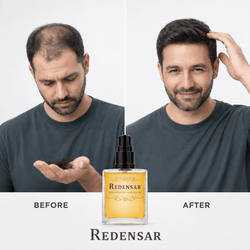 Hair Regrowth Serum Redensar by Alchemy Laboratories